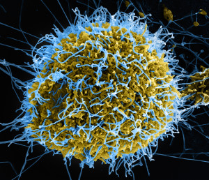 The Ebola virus. Source: Flickr user NIAID.